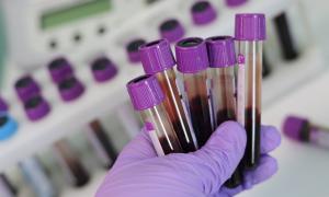 Test HIV negative